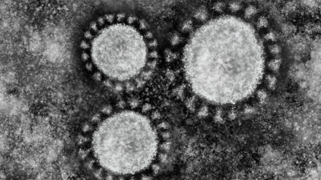 顕微鏡で見たウイルスのイメージ